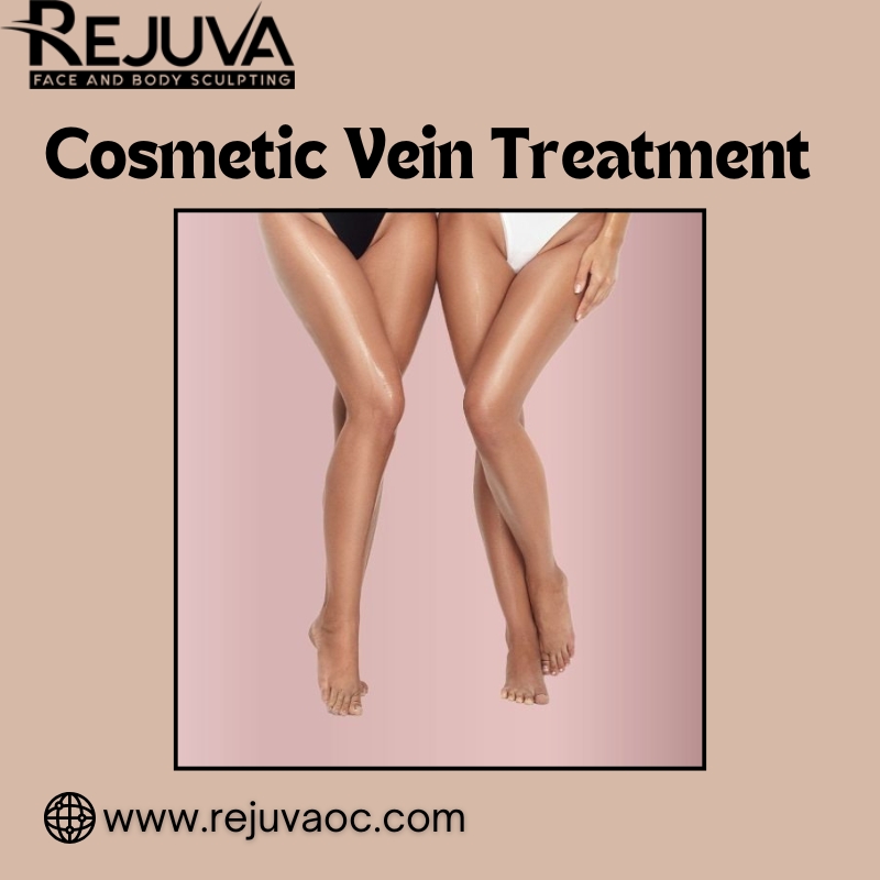 What Are the Benefits of Cosmetic Vein Treatment in Newport Beach?